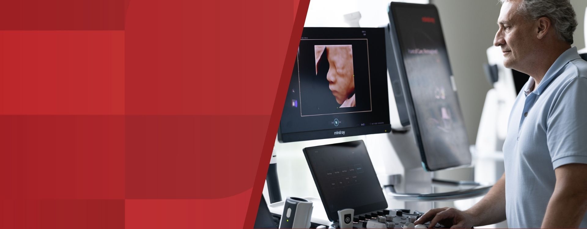 mindray service support warranty and repair