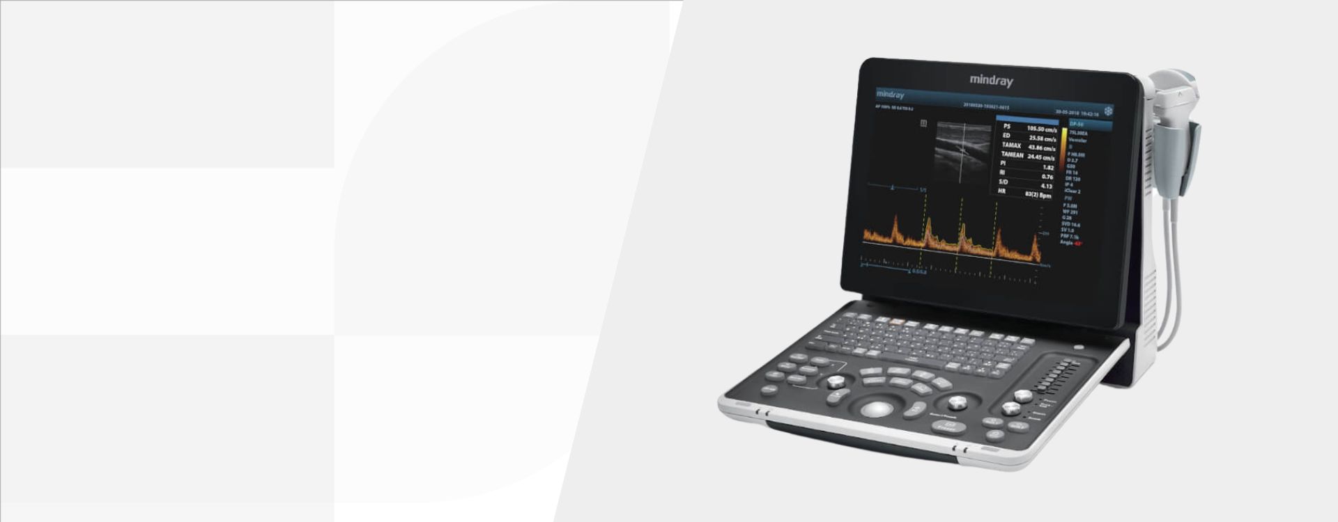 3rd Level Hero Image 1920x750 - mindray-ultrasound-dp-50-expert-mobile-ultrasound-system-1920x750-na