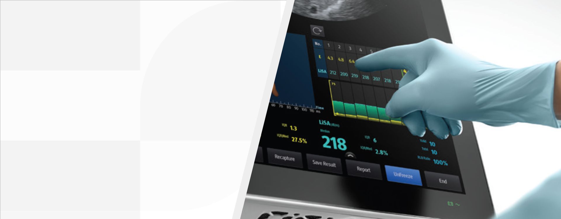 Product KV Component 1920x750 - mindray-ultrasound-hepatus-series-1920x750-na-v-1