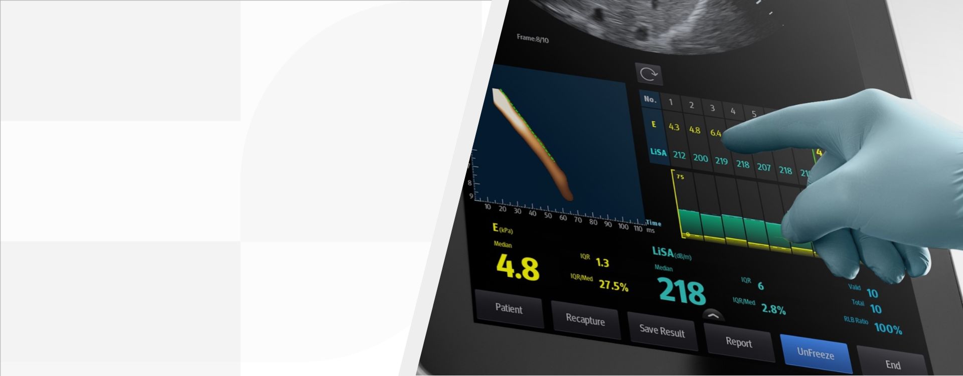 3rd Level Hero Image 1920x750 - mindray-ultrasound-hepatus-series-1920x750-na