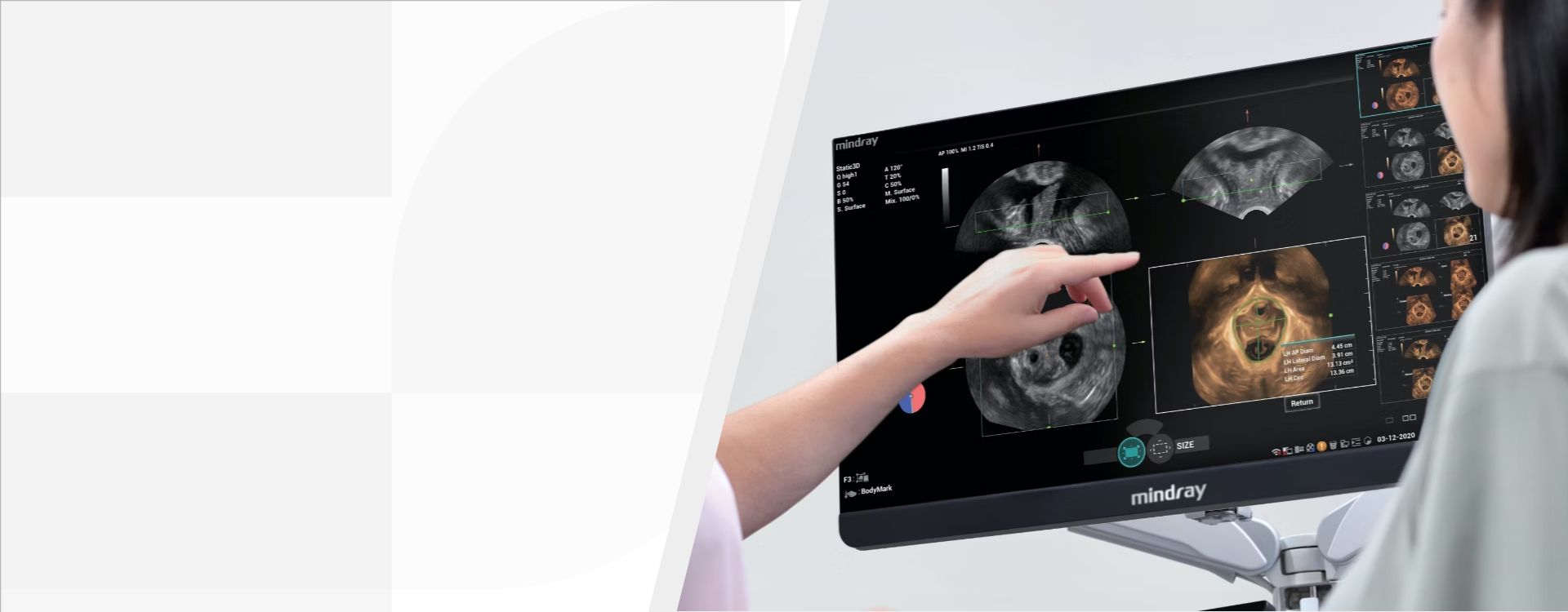 3rd Level Hero Image 1920x750 - mindray-ultrasound-imagyni9-ultrasound-imaging-1920x750-na