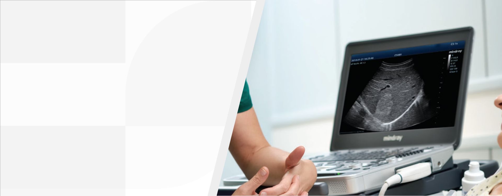 3rd Level Hero Image 1920x750 - mindray-ultrasound-m8-elite-diagnostic-ultrasound-system-1920x750-na