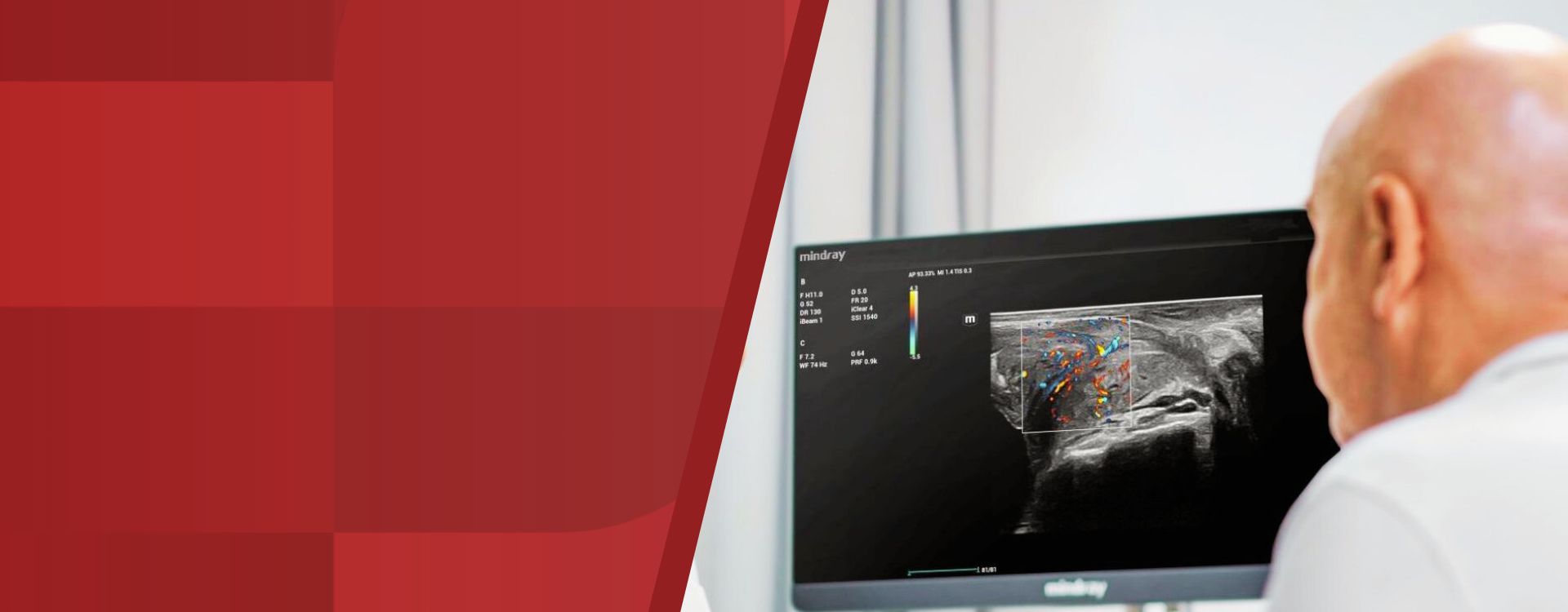 Products Level Hero Image 1920x750 - mindray-ultrasound-machines-hero-1920x750-na (2)