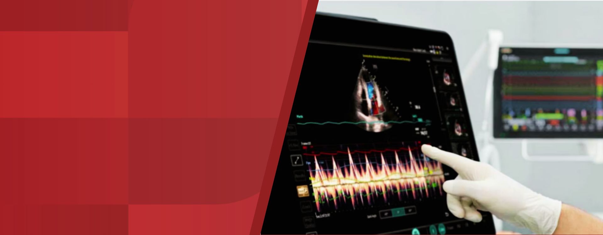 2nd Level Hero Image 1920x750 - mindray-ultrasound-portable-ultrasound-1920x750-na
