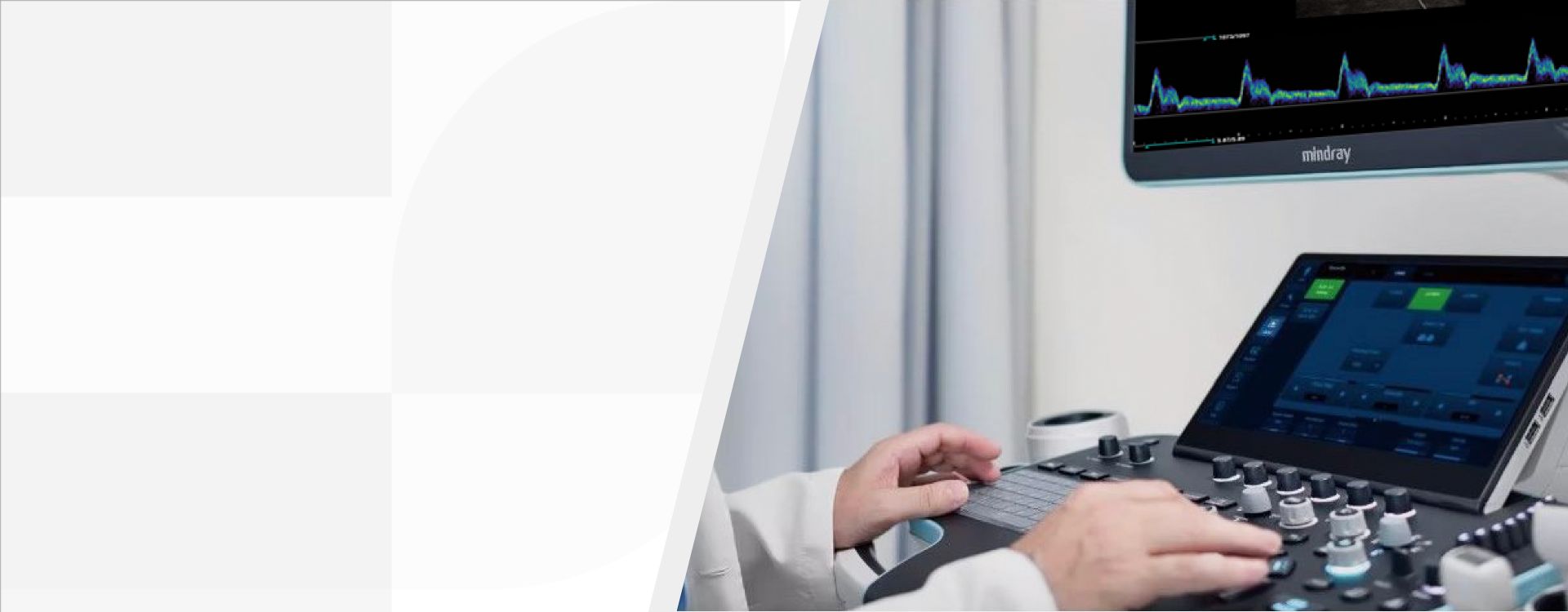 3rd Level Hero Image 1920x750 - mindray-ultrasound-resona-7-1920x750-na