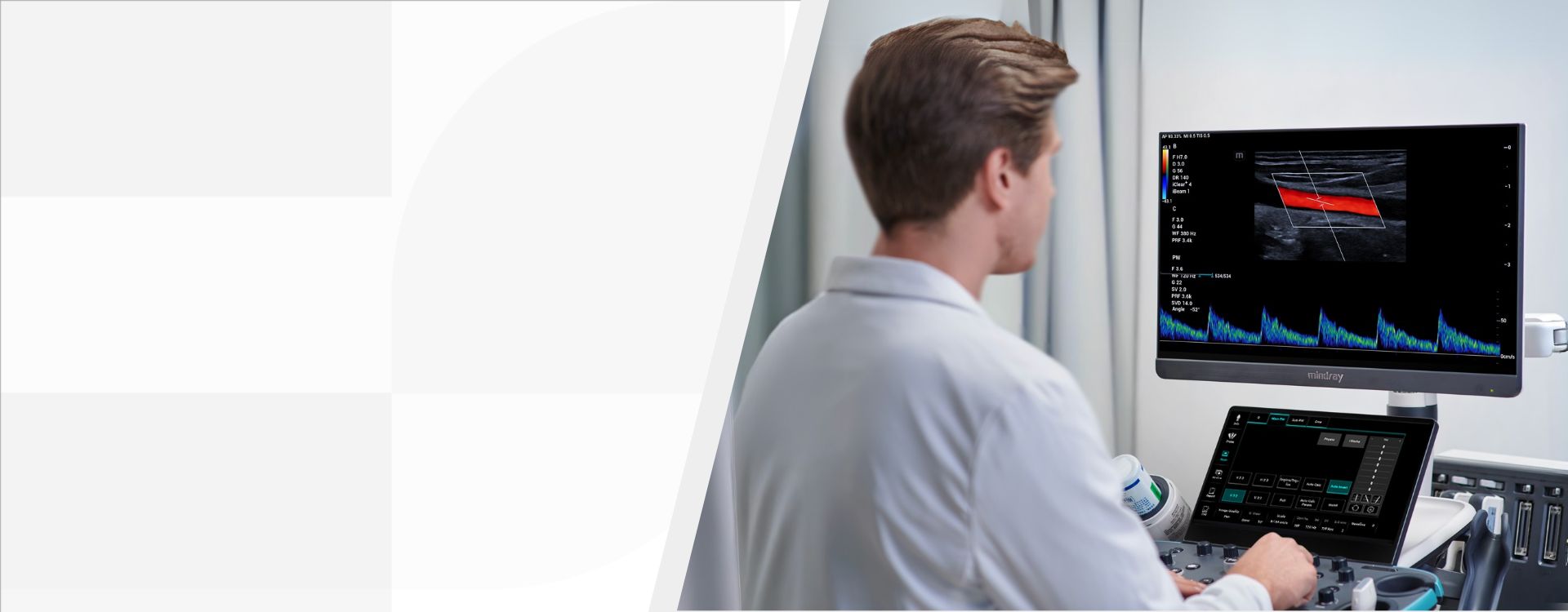 3rd Level Hero Image 1920x750 - mindray-ultrasound-resona-I8-ultrasound-machine-1920x750-na