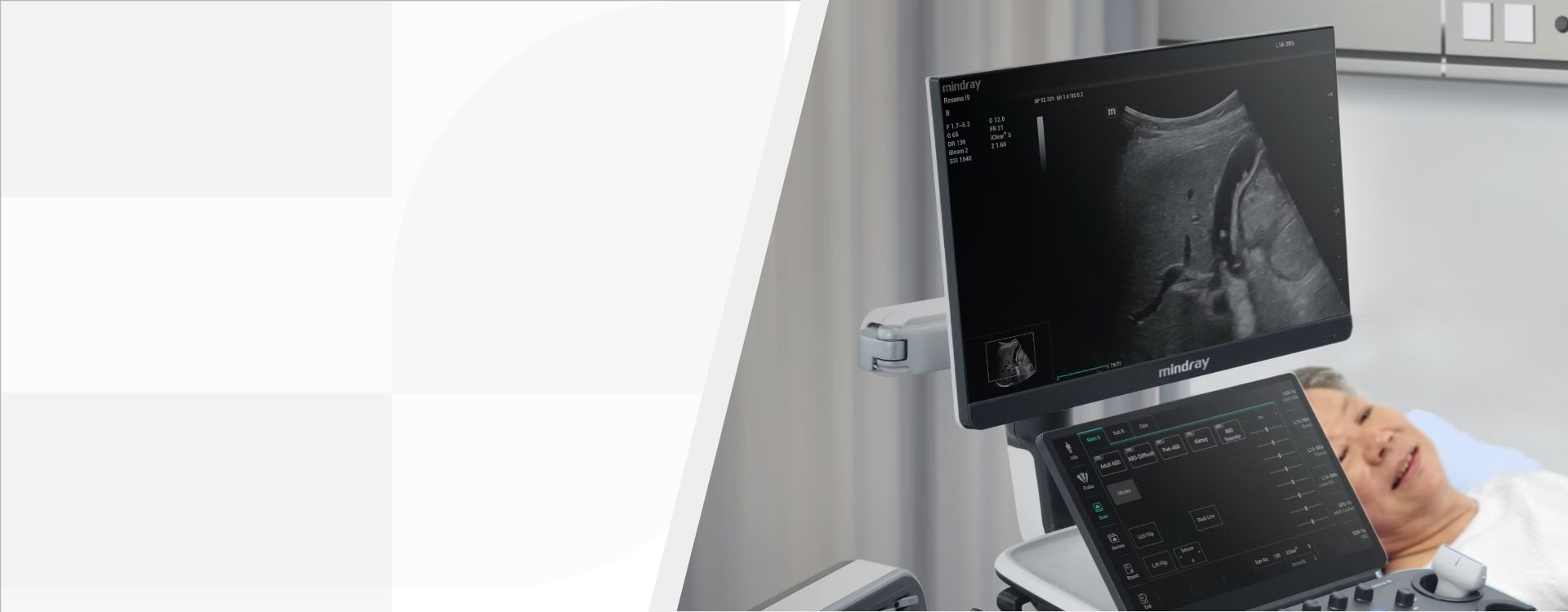 3rd Level Hero Image 1920x750 - mindray-ultrasound-resona-I9-ultrasound-machine-1920x750-na