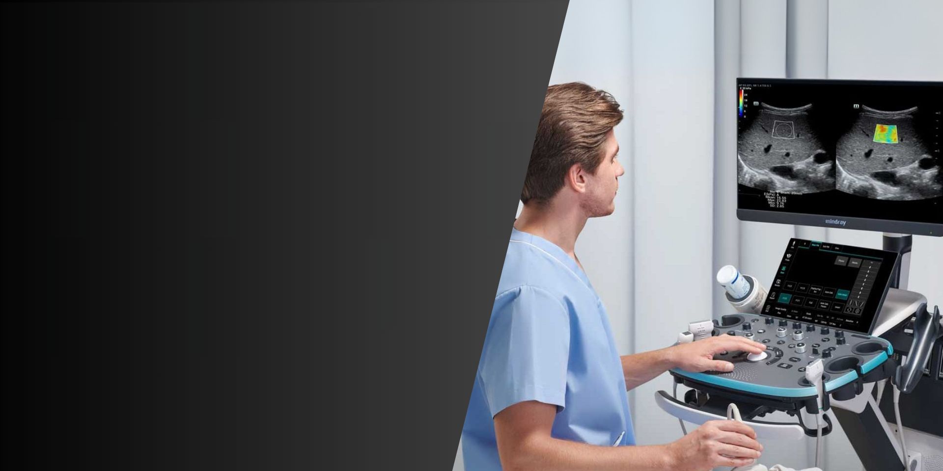 Mindray Resona i8 Ultrasound System – Homepage Hero Image