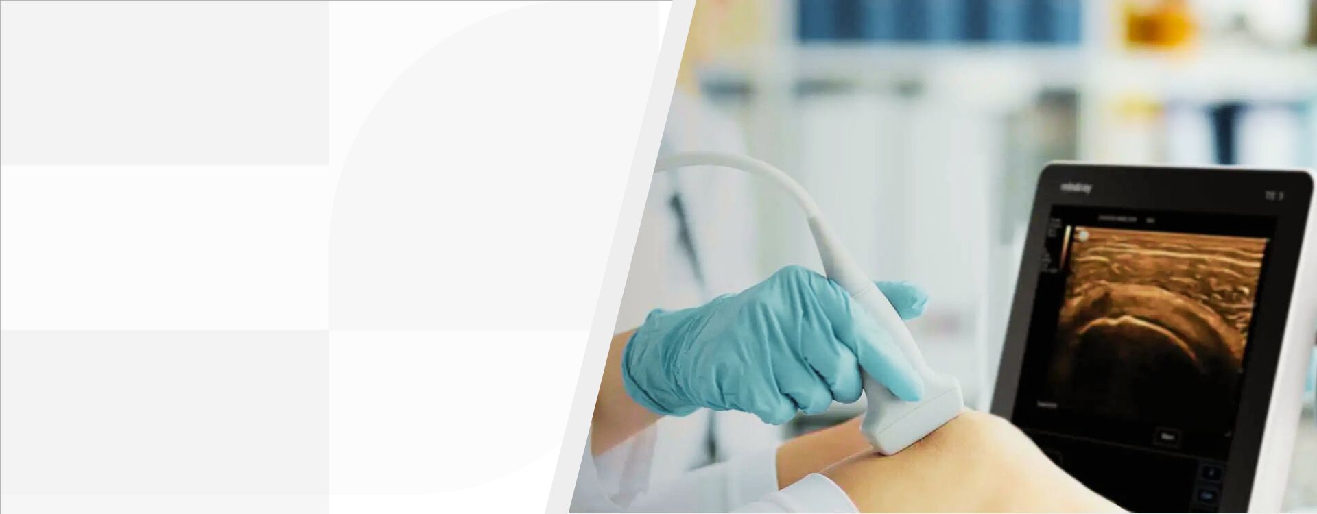 3rd Level Hero Image 1920x750 - mindray-ultrasound-te5-ultrasound-system-1920x750-na