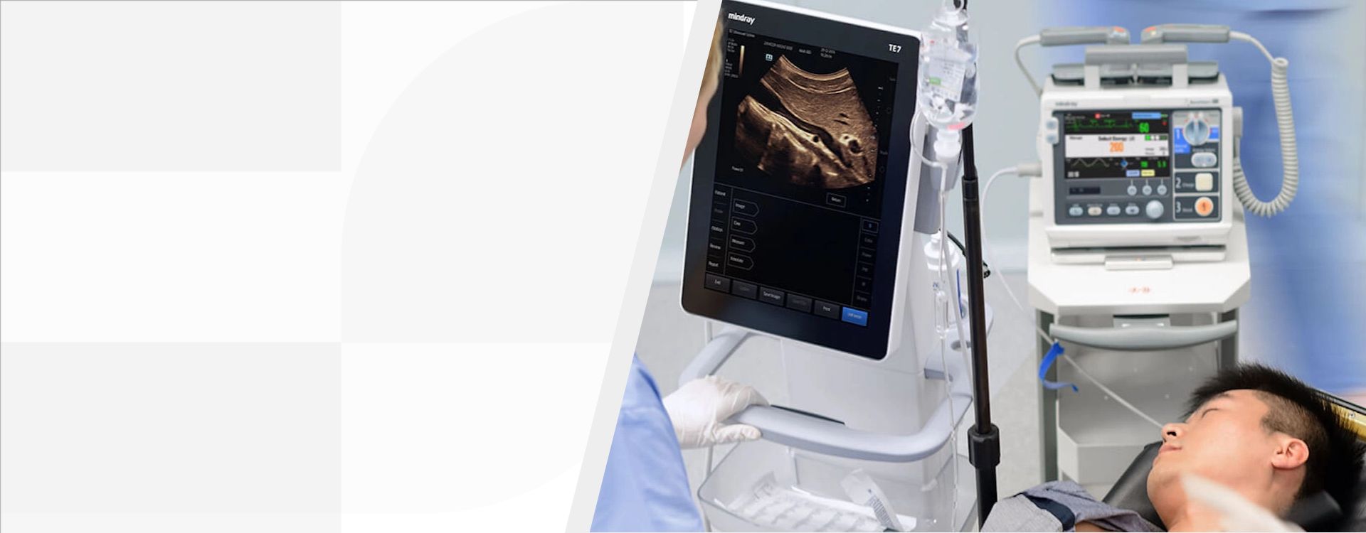 3rd Level Hero Image 1920x750 - mindray-ultrasound-te7-ultrasound-system-1920x750-na