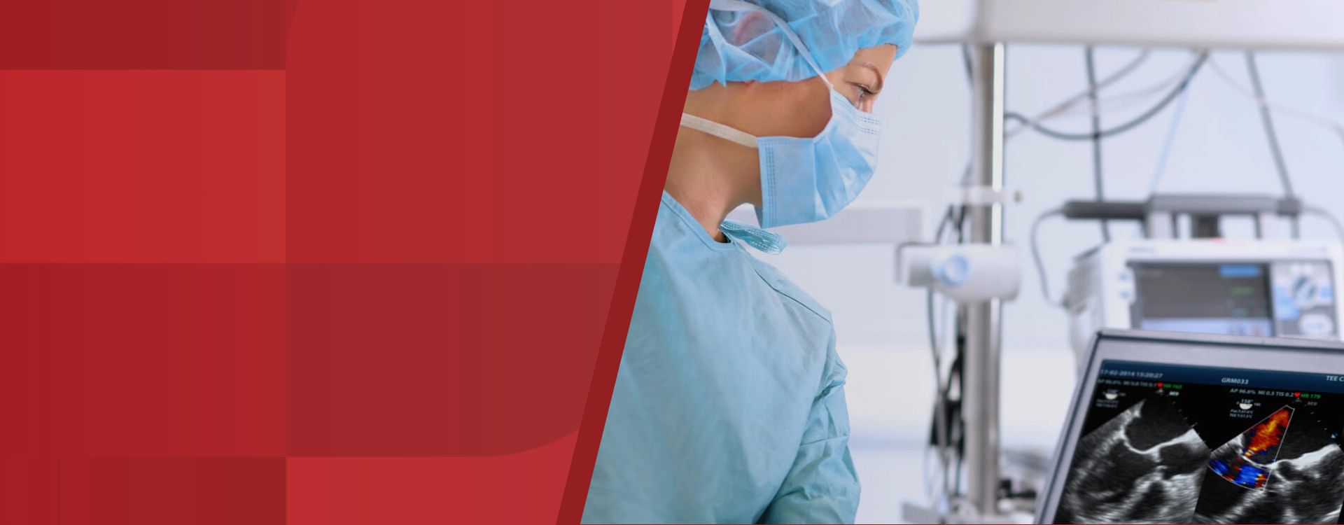 2nd Level Hero Image 1920x750 - mindray-ultrasound-zone-sonography-technology-1920x750-na