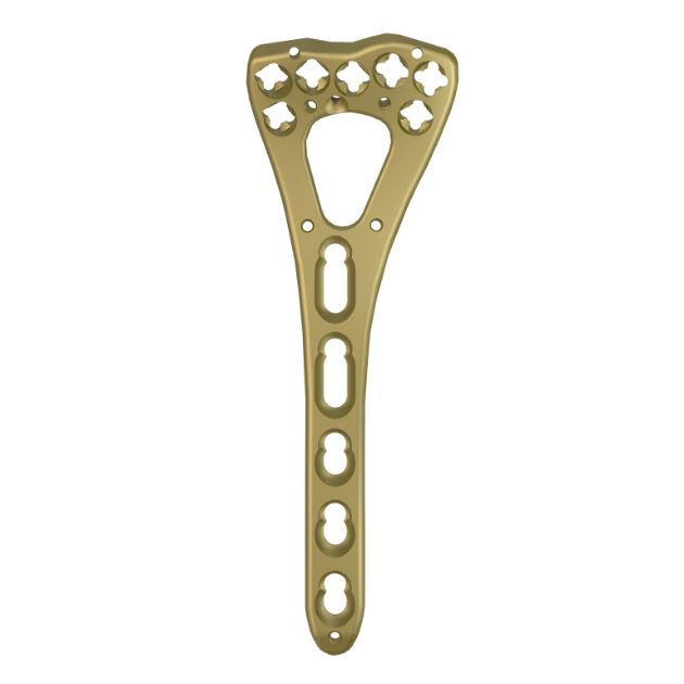 Locking Plate - Radius