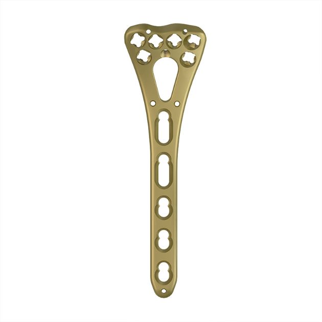 Locking Plate - Radius