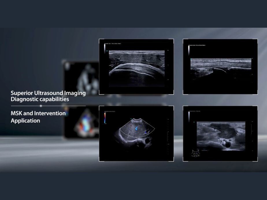 Msk and Intervention App from video