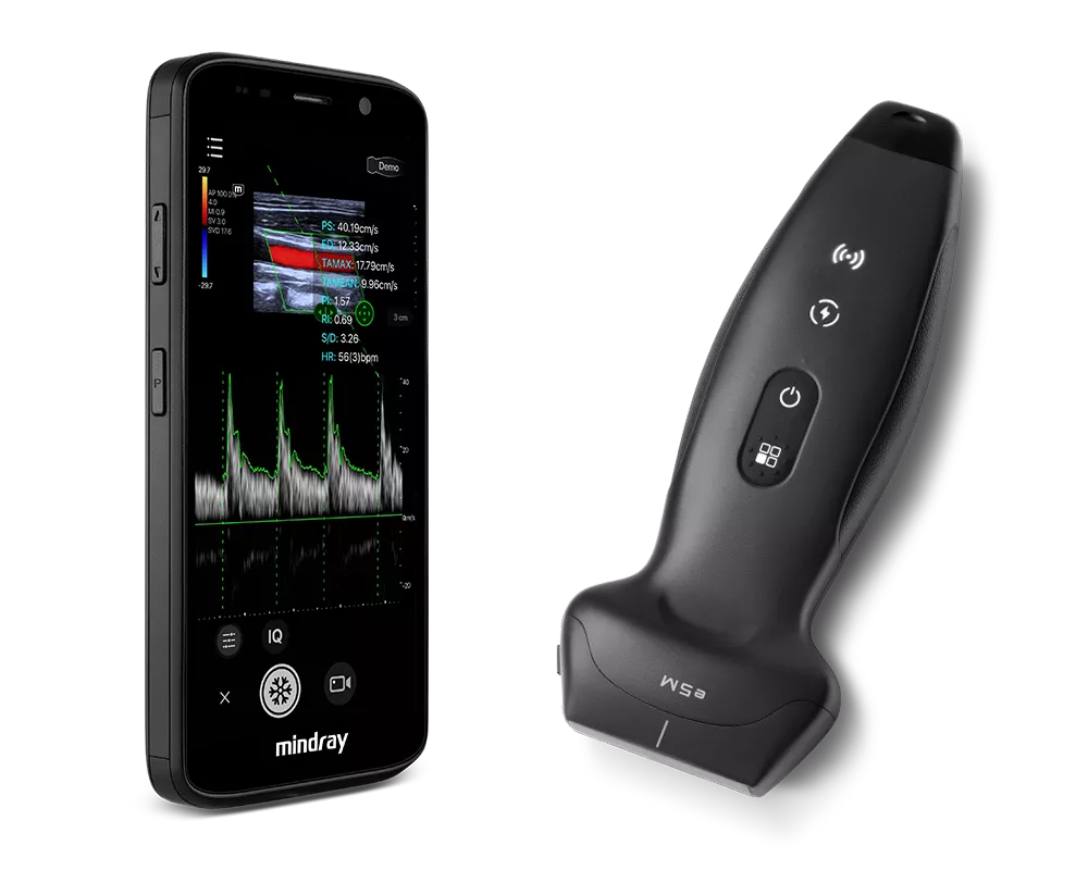 AirSight et sonde TE Air