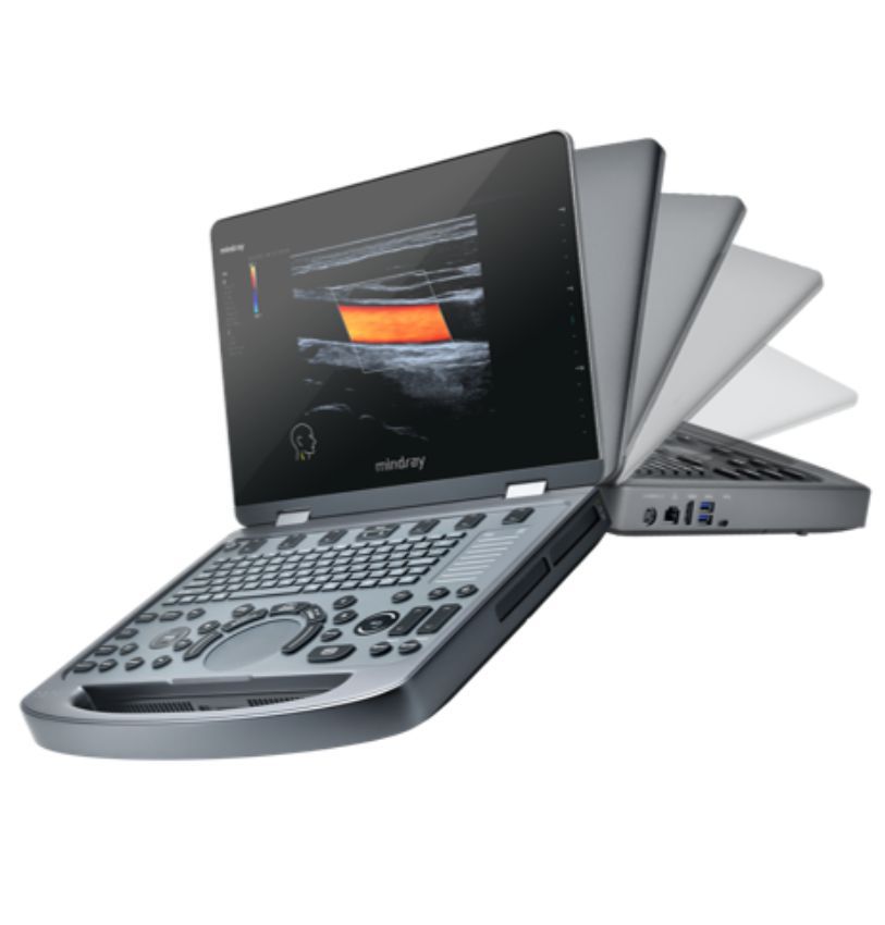 MX3