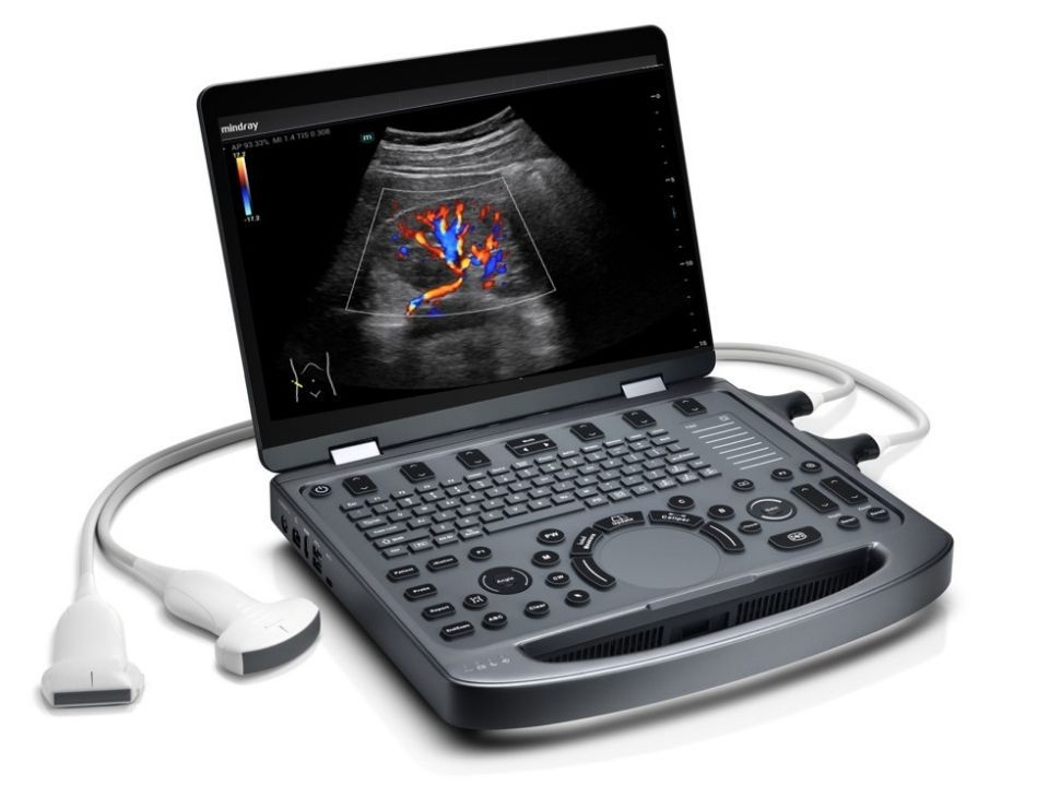 MX3 Portable