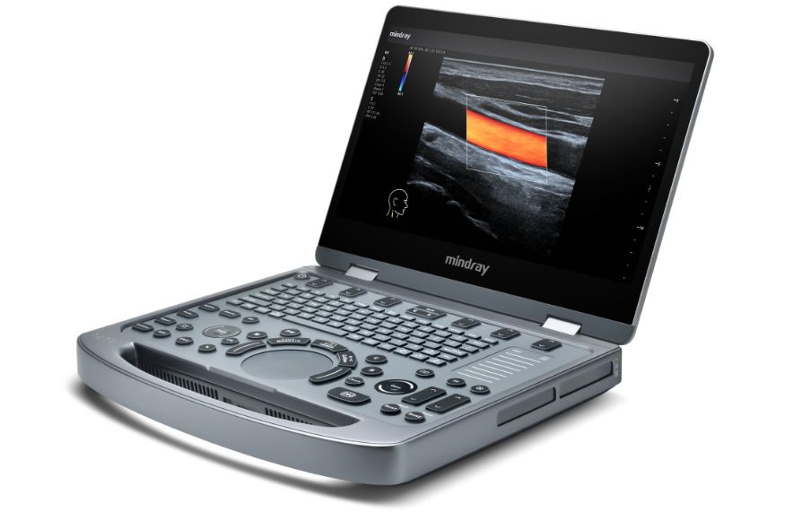 MX3 Compact Ultrasound System Product image - right view