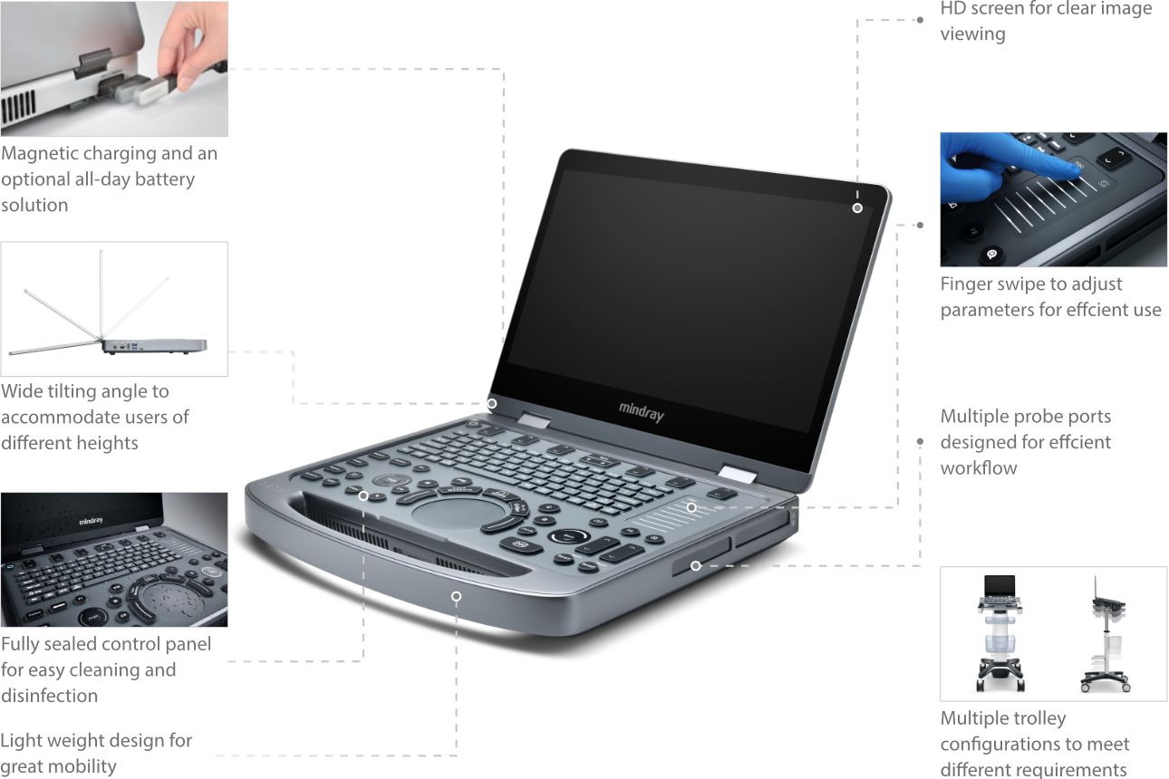 MX5 Compact Ultrasound System - Easy Use with Effortless Portability features