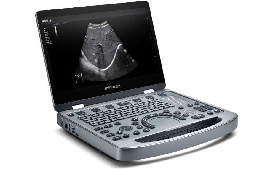 MX5 Compact Ultrasound System Product image - left view