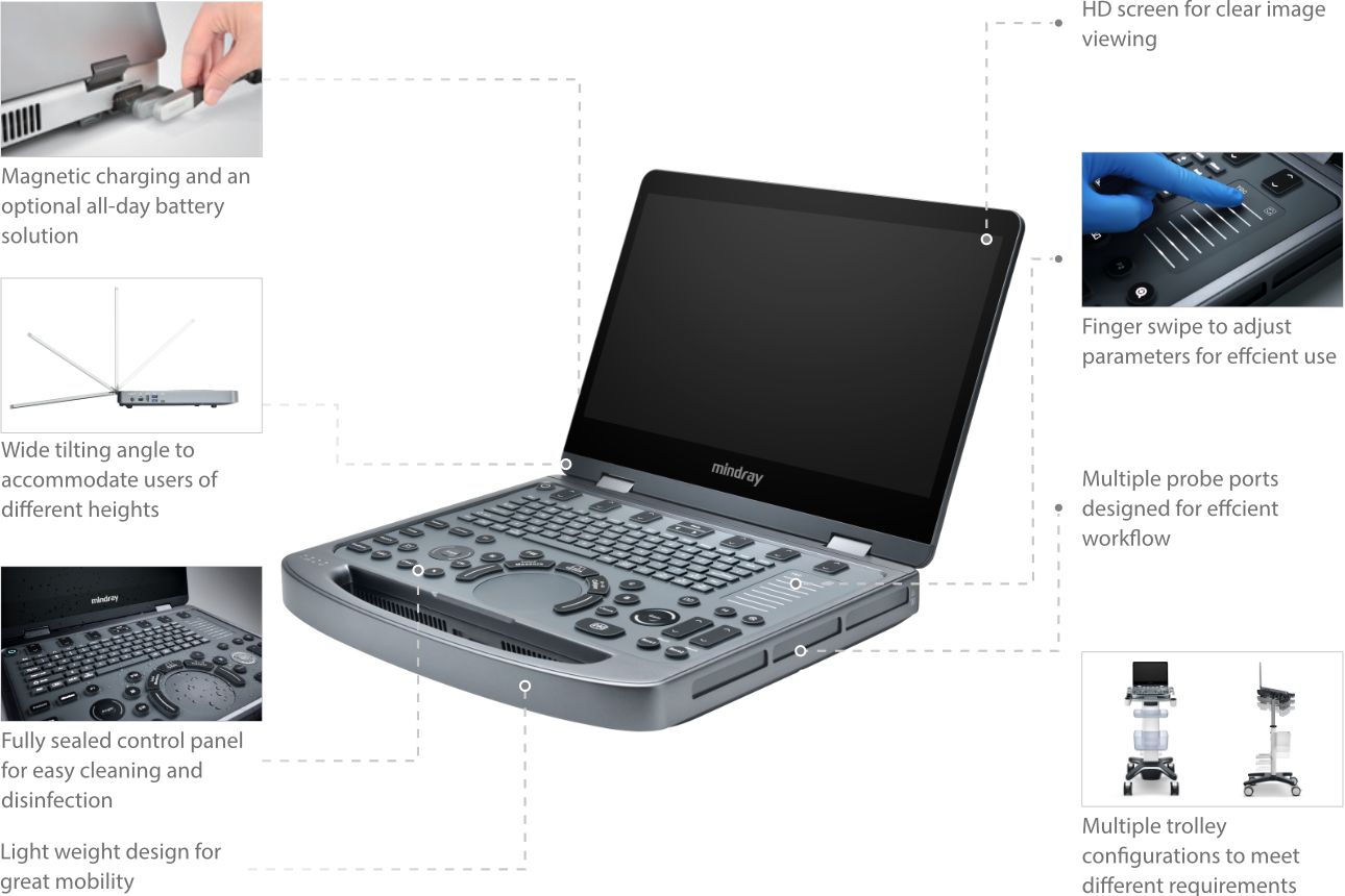 MX6 Compact Ultrasound System - Easy Use with Effortless Portability features