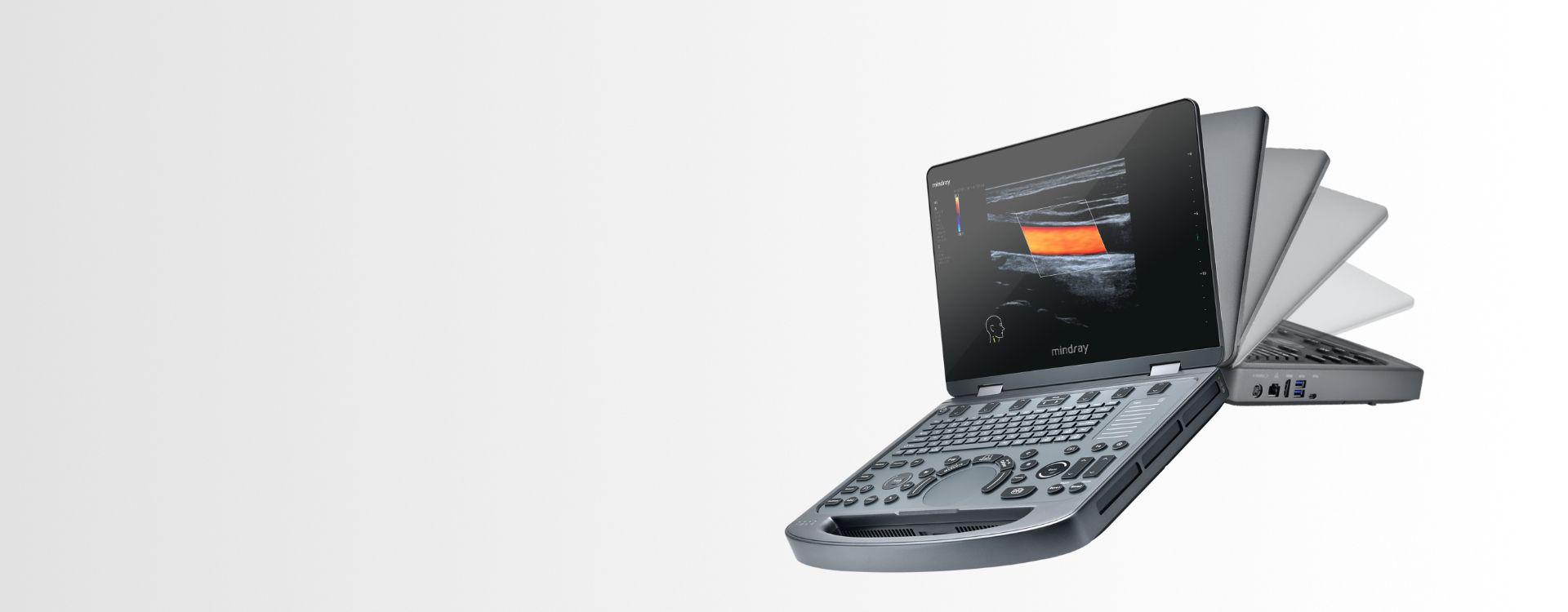 MX6 Compact Ultrasound System - Key visual banner
