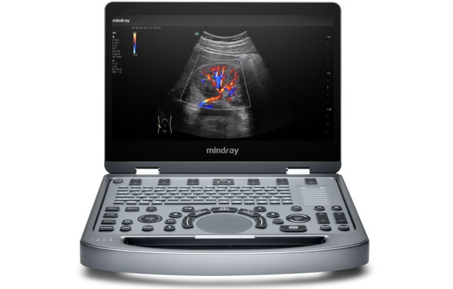 MX6 Compact Ultrasound System product image - front view