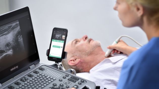 MX6 Compact Ultrasound System - Remote collaboration and training on MiCo+