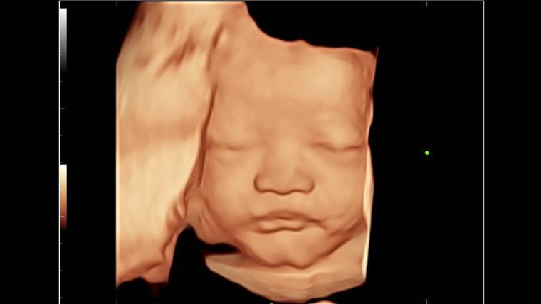 OB GYN