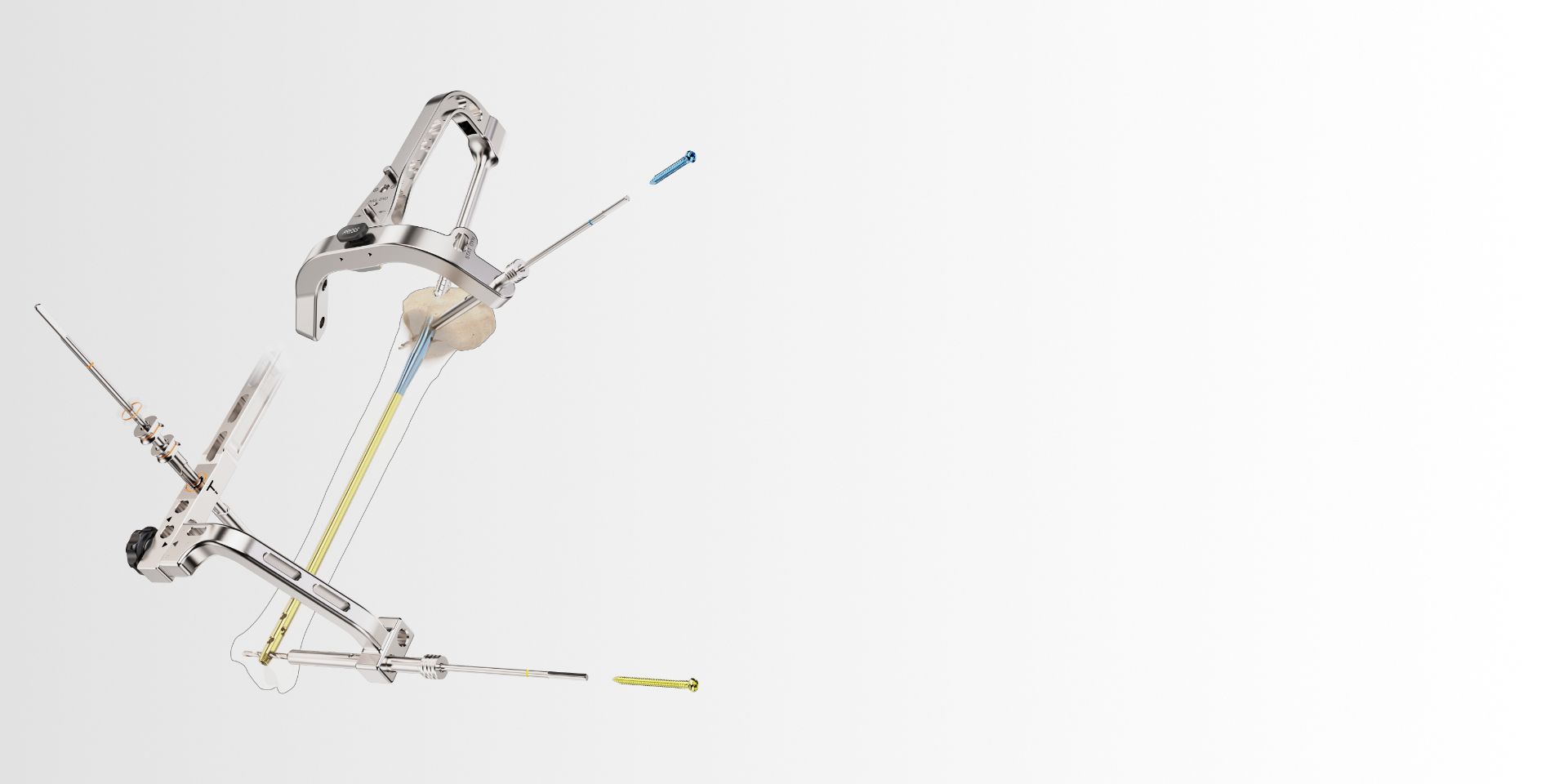 orthopaedics-mr-im-tribial-nail-kv-pc-1.0-en