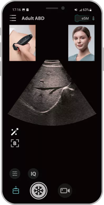 Capture d'écran de l'application MiCo+ pour la télémédecine
