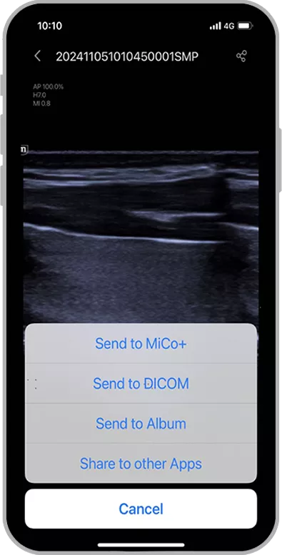 Capture d'écran de l'application MiCo+ pour le partage d'images