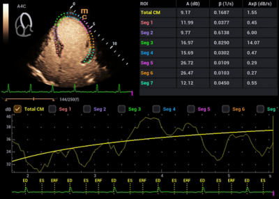 Recho R9 Contrast-enhanced Echocardiography - Echo Contrast Imaging QA image
