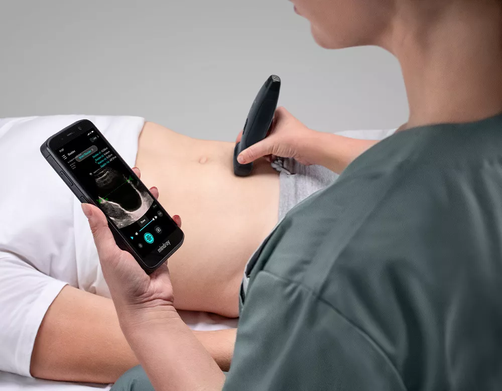 Un radiologue utilise un scanner abdominal TE Air e5M pour réaliser un examen sur le patient