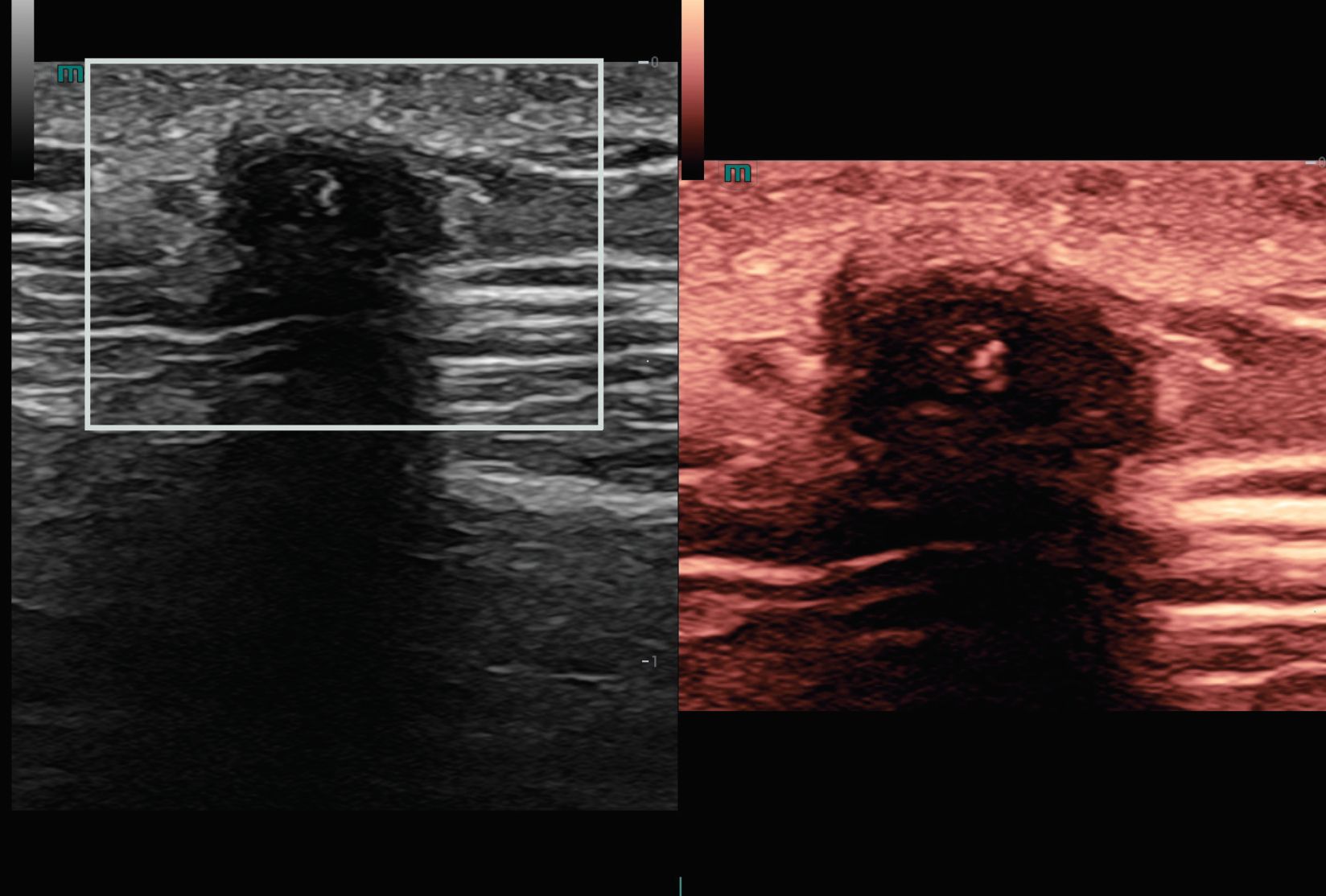 resona-a20-mindray-ultra-precise-na