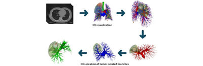 Observation of tumor related branches