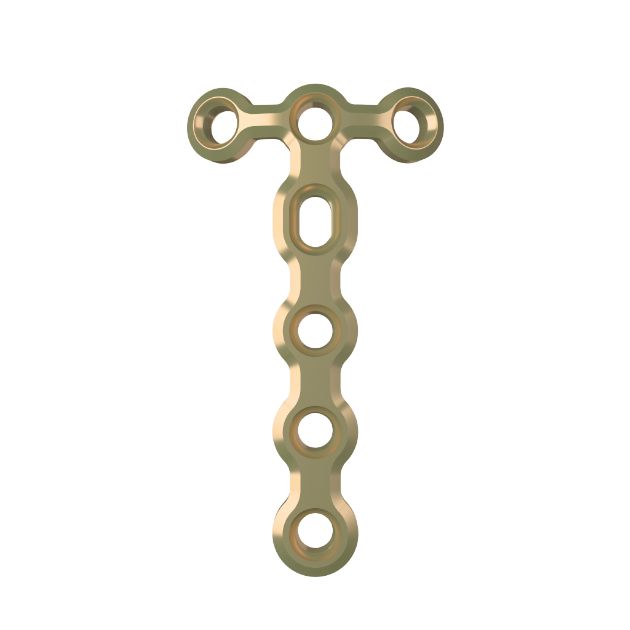 Locking Plate - Hand