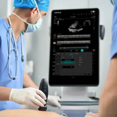 TE Air - Mindray Wireless Handheld Ultrasound System - Mindray