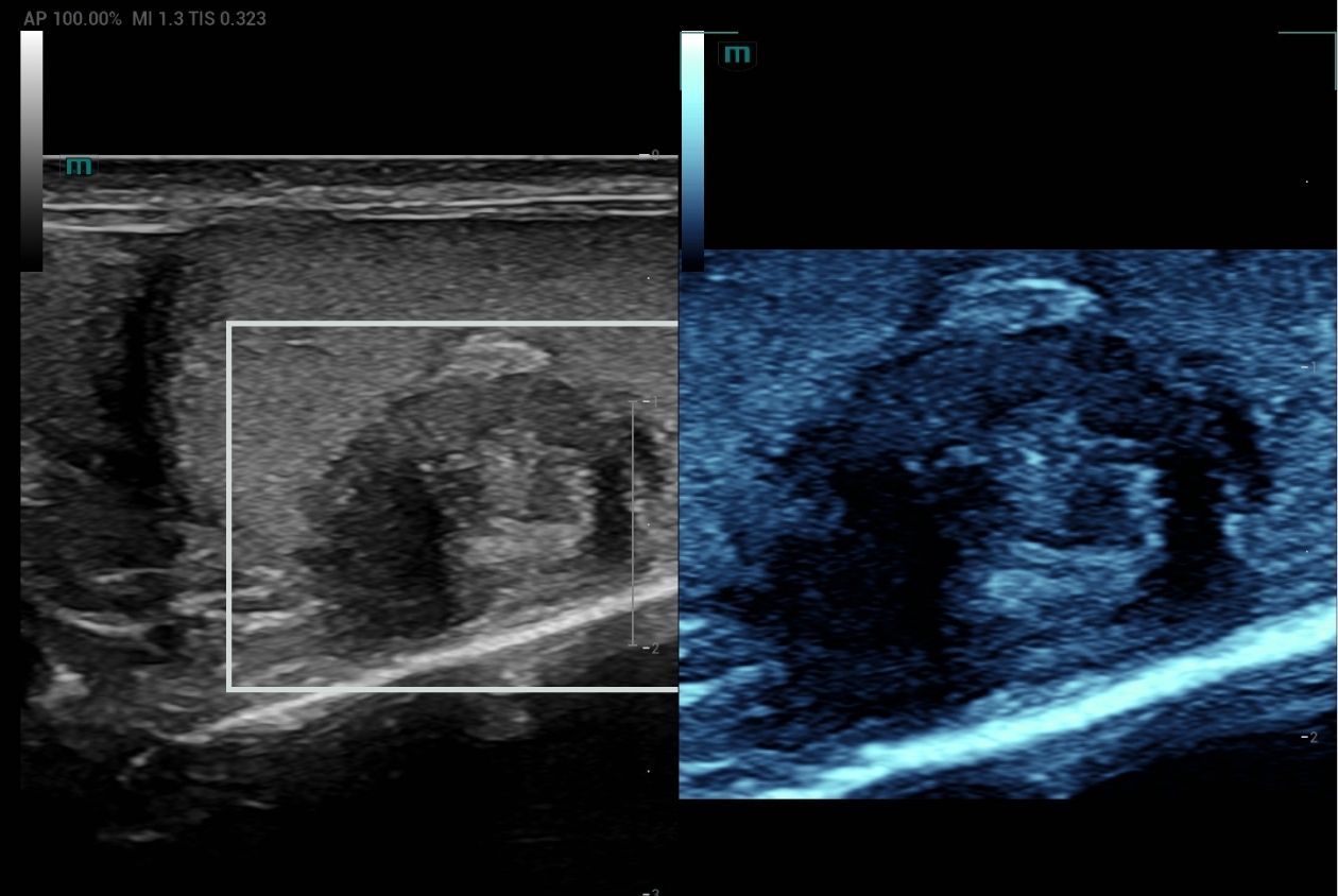 Product Image List Swiper Component 1260x844 - testicular-lesion-with-hd-scope-1260x844