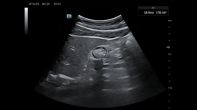 TEX20 Elite Edition Advanced Tools Clinical Image - Auto GA