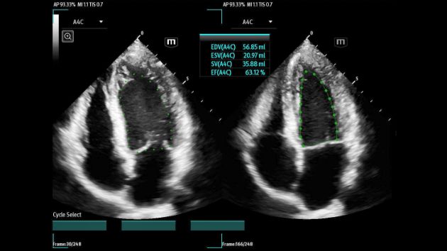TEX20 Elite Edition Advanced Tools Clinical Image - AutoEF Plus