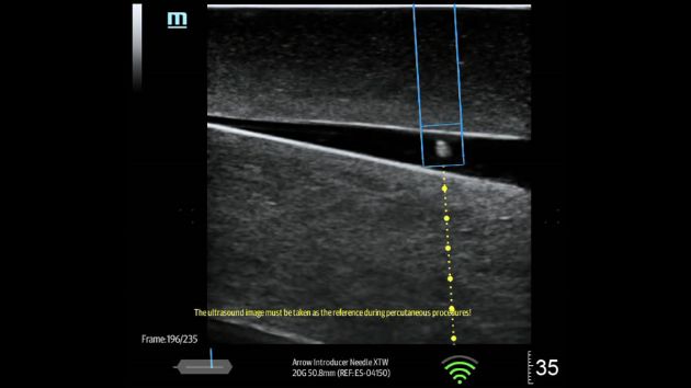 TEX20 Elite Edition Advanced Tools Clinical Image - eSpacial Navi