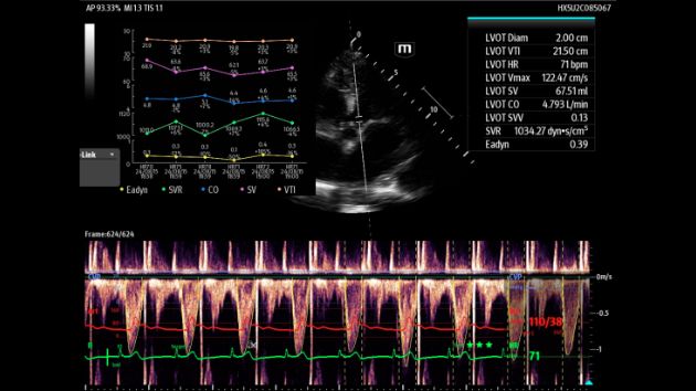 TEX20 Elite Edition Advanced Tools Clinical Image - Smart Fluid Management