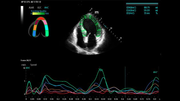 TEX20 Elite Edition Advanced Tools Clinical Image - Smart TTQA