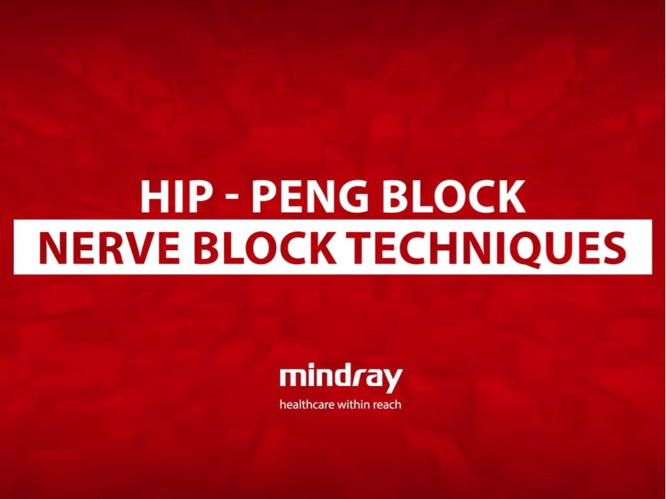 Product Teaser E Component 960x720 - the-block-show-hip-960x720