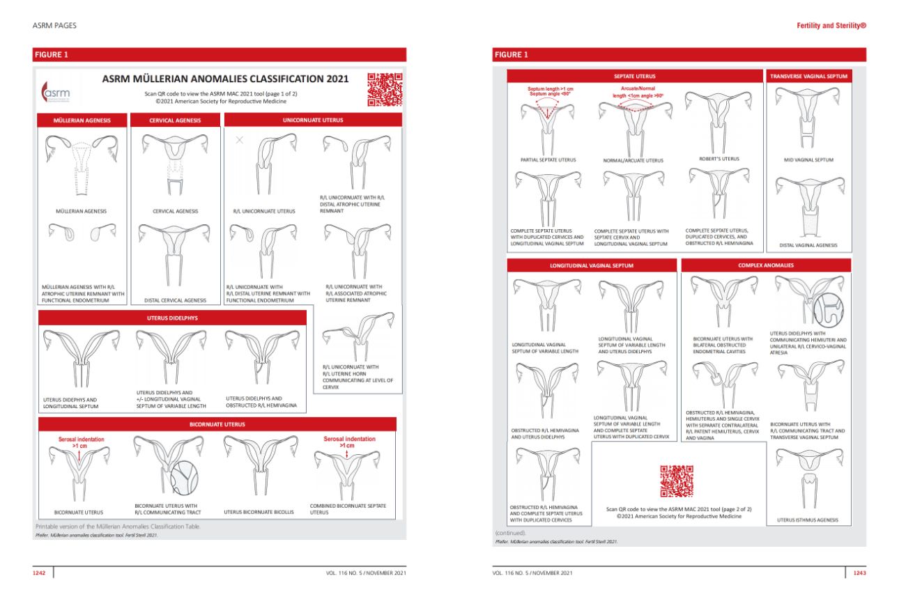 2021 ASRM mullerian anomalies classification