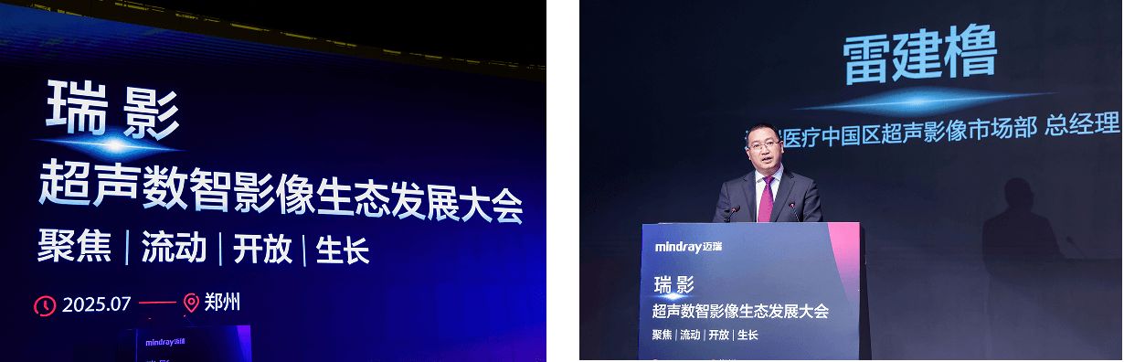 ultrasound-intelli-digital-01