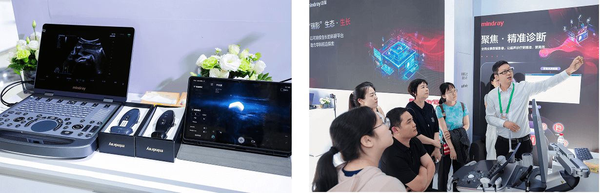 ultrasound-intelli-digital-03