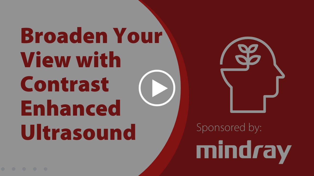 webinar-thumbnail - 9