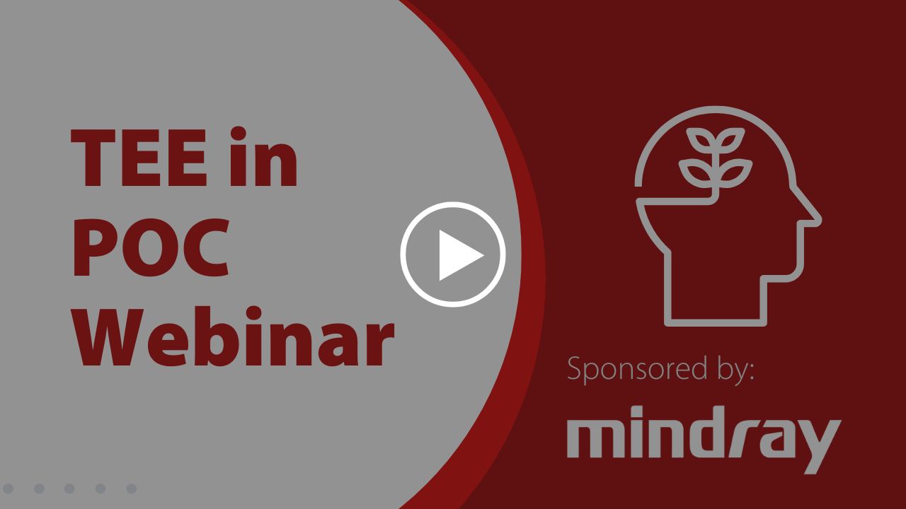 webinar-thumbnail - 6